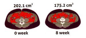 AshiSlim Study