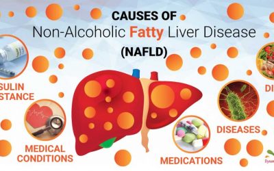 Causes of Fatty Liver (Nonalcoholic and Steatohepatitis)