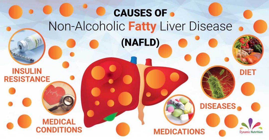 Causes of Fatty Liver (Nonalcoholic and Steatohepatitis)