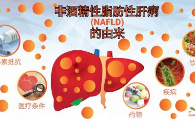 脂肪肝的由來（非酒精性和脂肪性肝炎）