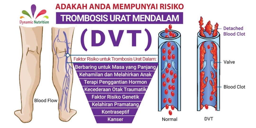 Deep Vein Thrombosis (DVT)