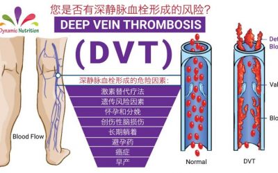 您是否有深静脉血栓形成的风险？