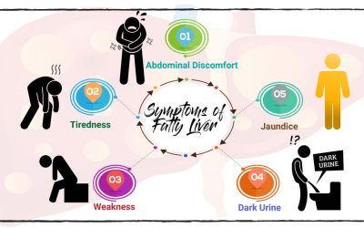 Symptoms of Fatty Liver