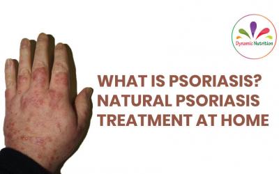 What is Psoriasis? Natural Psoriasis Treatment At Home