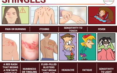 Shingles: Symptoms, Causes And Natural Treatment
