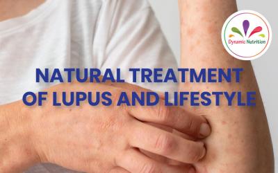 Natural Treatment Of Lupus And Lifestyle