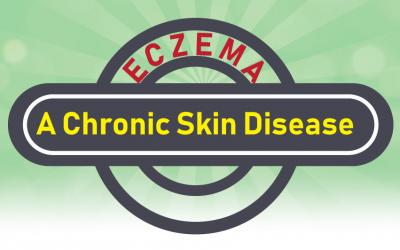 Eczema – A Chronic Skin Disease