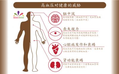 高血压的危险因素及控制它的简单步骤