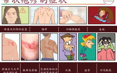 带状疱疹：症状、原因和自然治疗