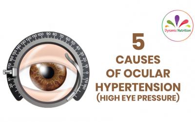 5 Causes of Ocular Hypertension