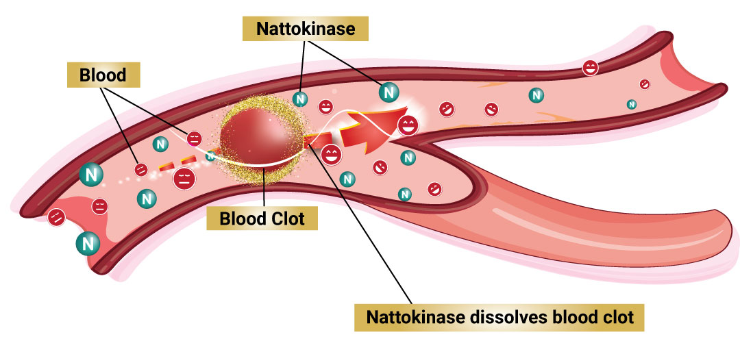 nattokinase