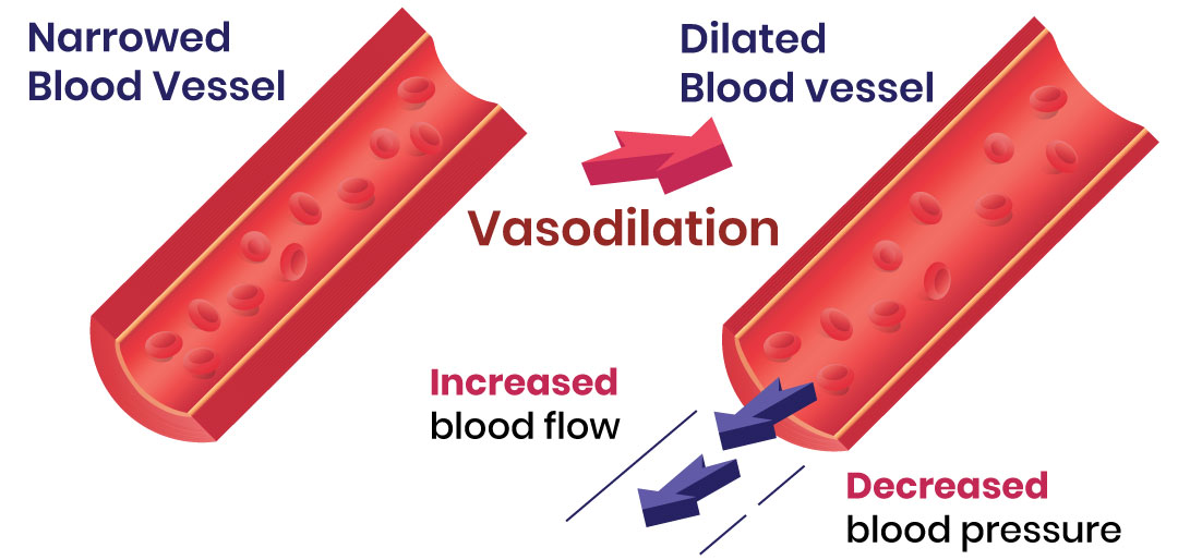 vasodilation